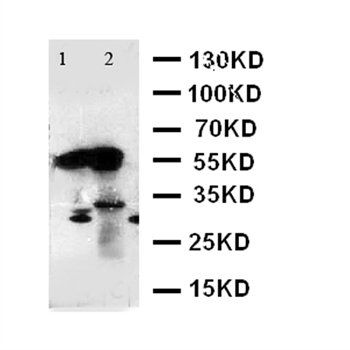 Alpha Amylase 1/AMY1A Rabbit Polyclonal Antibody