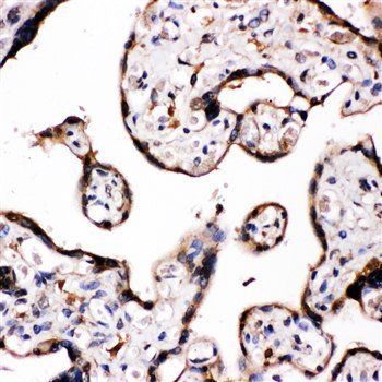 Aromatase/CYP19A1 Rabbit Polyclonal Antibody
