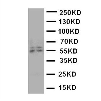 Aromatase/CYP19A1 Rabbit Polyclonal Antibody