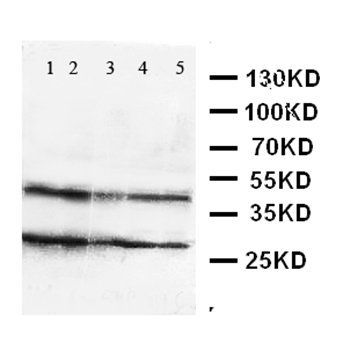 GPR2/CCR10 Rabbit Polyclonal Antibody