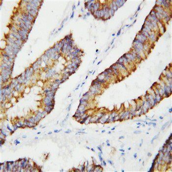 BCAT2 Rabbit Polyclonal Antibody