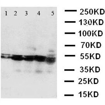BCAT2 Rabbit Polyclonal Antibody