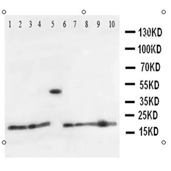Ribonuclease A/RNASE1 Rabbit Polyclonal Antibody