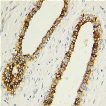 Caspase-1/CASP1 Rabbit Polyclonal Antibody