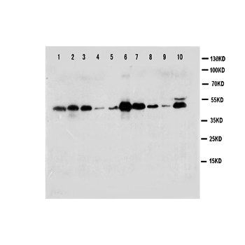 Caspase-1/CASP1 Rabbit Polyclonal Antibody