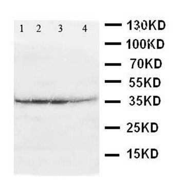 ATF4 Rabbit Polyclonal Antibody