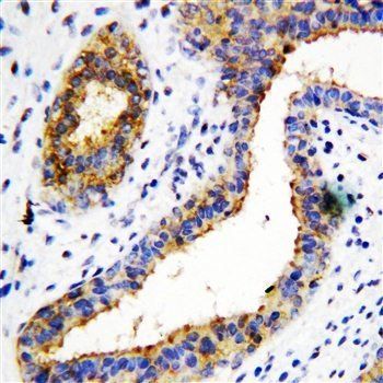 BCAT1 Rabbit Polyclonal Antibody