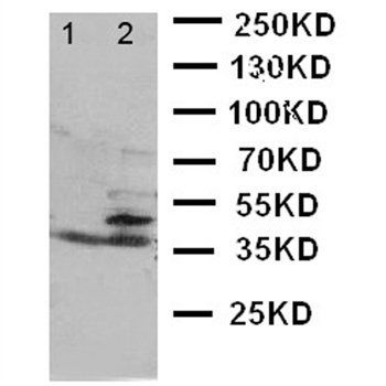 BCAT1 Rabbit Polyclonal Antibody