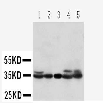 Cyclin-dependent kinase 1 CDK1 Rabbit Polyclonal Antibody