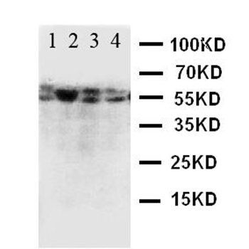 CD89/FCAR Rabbit Polyclonal Antibody