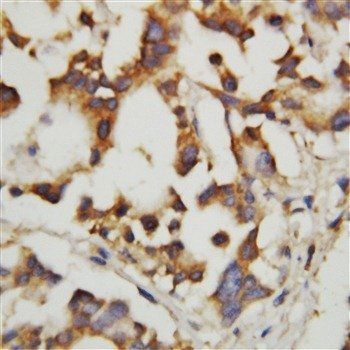 Cystathionase/CTH Rabbit Polyclonal Antibody