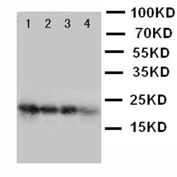 Fibroblast growth factor 1 FGF1 Rabbit Polyclonal Antibody