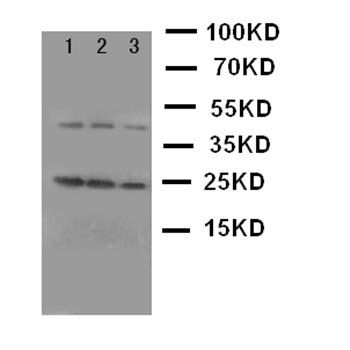 Growth Hormone/GH1 Rabbit Polyclonal Antibody