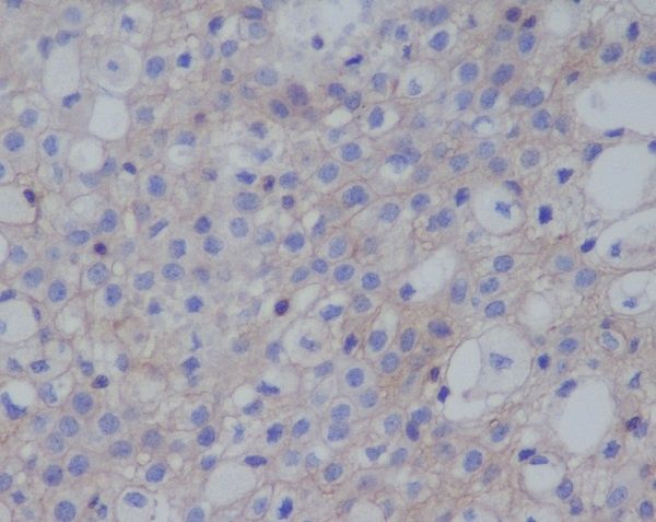 PD-L1/PD Rabbit Monoclonal Antibody