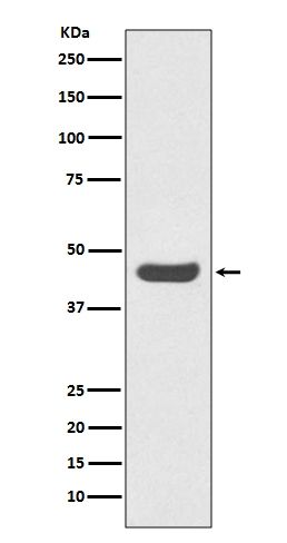 PD-L1/PD Rabbit Monoclonal Antibody