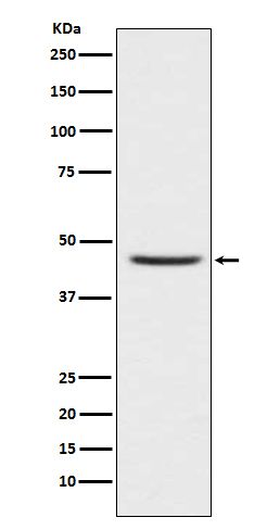 CCR8 Rabbit Monoclonal Antibody