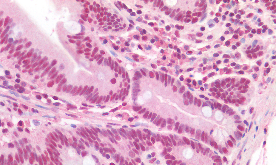 Goat anti-TICAM1 Antibody