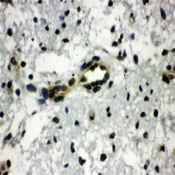 C-terminal-binding protein 1 CtBP1 Rabbit Polyclonal Antibody