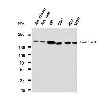 Laminin gamma 1/LAMC1 Rabbit Polyclonal Antibody