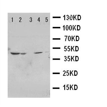 Prostaglandin E Receptor EP1/PTGER1 Rabbit Polyclonal Antibody