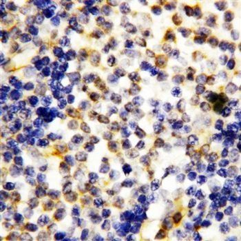 Granzyme A/GZMA Rabbit Polyclonal Antibody