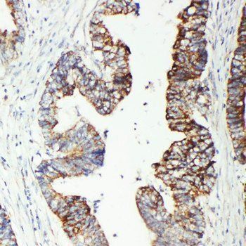GST3/GST pi/GSTP1 Rabbit Polyclonal Antibody