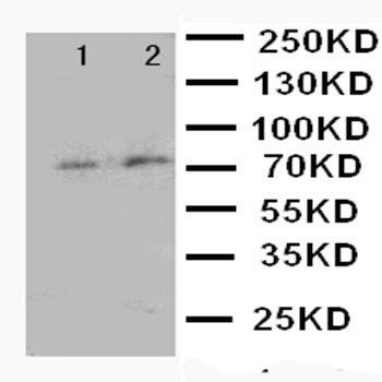 Forkhead box protein P1 FOXP1 Rabbit Polyclonal Antibody