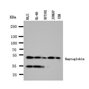 Haptoglobin/HP Rabbit Polyclonal Antibody