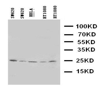 Homeobox protein Hox-A6 HOXA6/A6 Rabbit Polyclonal Antibody