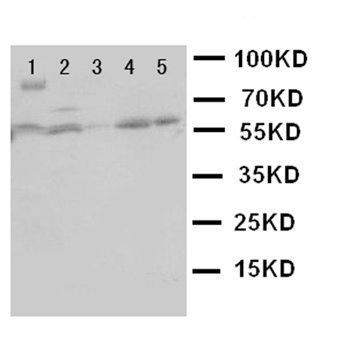 Heat shock factor protein 2 HSF2 Rabbit Polyclonal Antibody