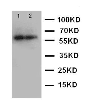 IL2 Receptor beta/IL2RB Antibody