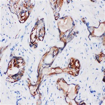 Kallikrein 2/KLK2 Rabbit Polyclonal Antibody
