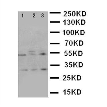 Kallikrein 2/KLK2 Rabbit Polyclonal Antibody