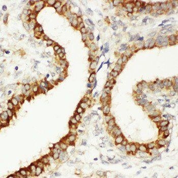 Integrin beta 3/ITGB3 Rabbit Polyclonal Antibody