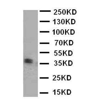 Kallikrein 5/KLK5 Rabbit Polyclonal Antibody