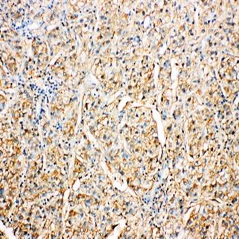 Kallistatin/SERPINA4 Rabbit Polyclonal Antibody