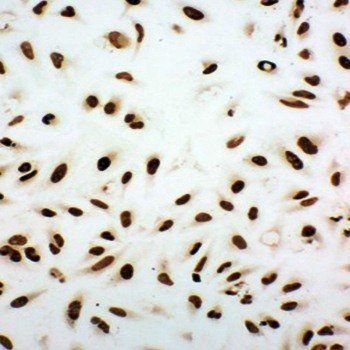 Ku80/XRCC5 Rabbit Polyclonal Antibody