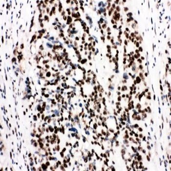 Ku80/XRCC5 Rabbit Polyclonal Antibody