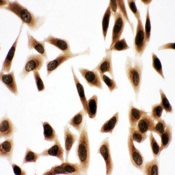 Bub3 Rabbit Polyclonal Antibody