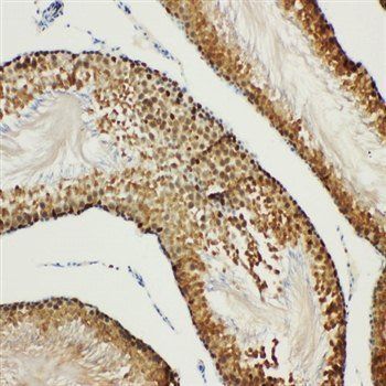 Bub3 Rabbit Polyclonal Antibody