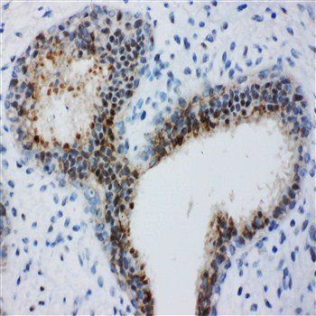 Bub3 Rabbit Polyclonal Antibody