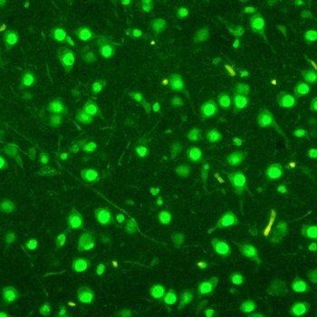 MCM2 Rabbit Polyclonal Antibody