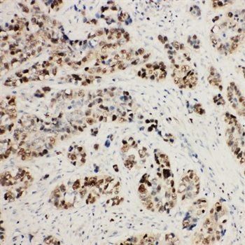 MCM2 Rabbit Polyclonal Antibody
