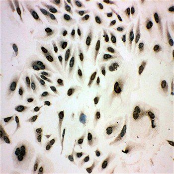 MCM3 Rabbit Polyclonal Antibody