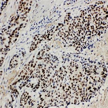 MCM3 Rabbit Polyclonal Antibody