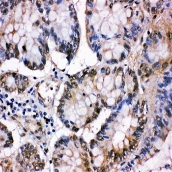 MCM5 Rabbit Polyclonal Antibody
