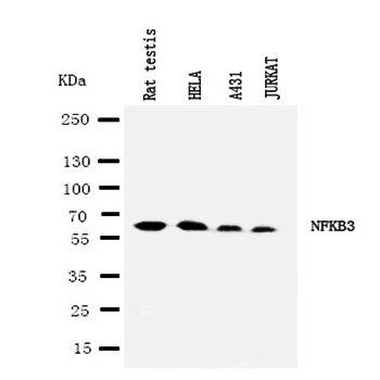 NF-kB p65/RELA/NF Rabbit Polyclonal Antibody