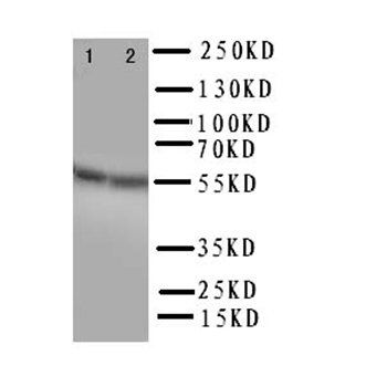 Retinal dehydrogenase 1 ALDH1A1 Rabbit Polyclonal Antibody