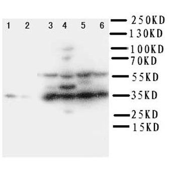 Podoplanin/gp36/PDPN Rabbit Polyclonal Antibody