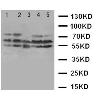 Neurokinin 1 Receptor/TACR1 Rabbit Polyclonal Antibody